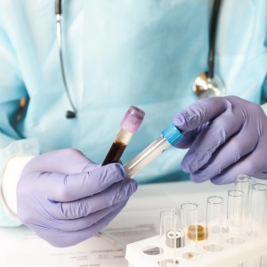 Individuální diagnostika a pokročilé laboratorní testy
